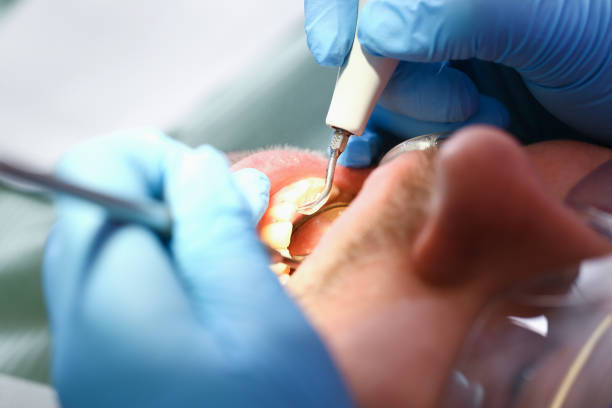 Best Emergency Denture Repair in Fall River, WI